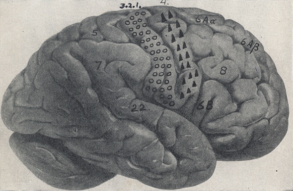 Figuur 1.Laterale (buitenzijde) zijde van de rechter grote hersenhelft